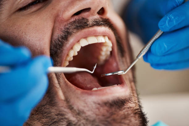 Best Emergency Dental Extractions in Kdeer, IL